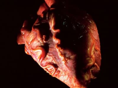 Metode Murah Baru Untuk Menghidupkan Kembali Jantung Anak Donor dan Tingkatkan Transplantasi