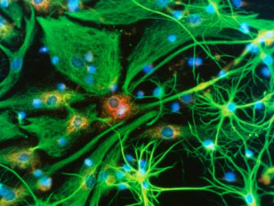 Kemajuan Terobosan CRISPR Mengobati Penyakit Otak Genetik dalam Waktu Dekat
