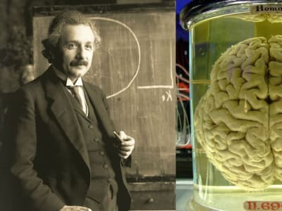 Teknologi Baru Buka Rahasia Jaringan Lama: Menelusuri Jejak Gen Einstein dan Kanker