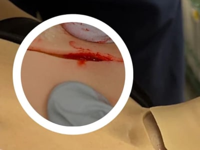 Teknologi Cetak 3D Baru Ciptakan Jaringan Manusia Realistis untuk Pelatihan Bedah