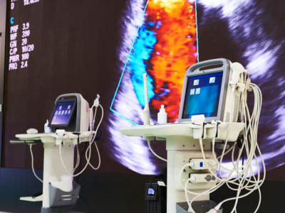 GE HealthCare dan Peluncuran Carestation 850: Peluang Besar di Tengah Tantangan Saham
