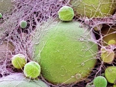 Mutasi Gen MC4R Sebabkan Obesitas Tapi Turunkan Risiko Penyakit Jantung