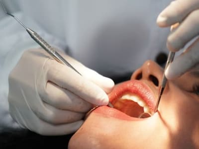 Mahkota Gigi Permanen 3D Cetak Zirconia Dalam Beberapa Jam Saja
