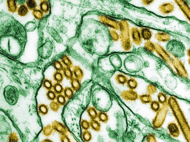 CDC Mengonfirmasi Kasus Pertama Flu Burung Parah di AS