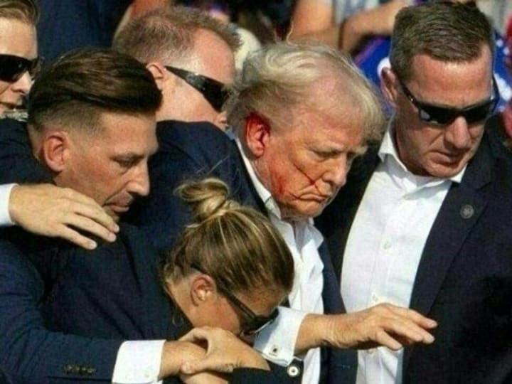 Tanda Keamanan Tinggi di Rumah Sakit yang Merawat Trump Harus Menjadi Minimum untuk Semua