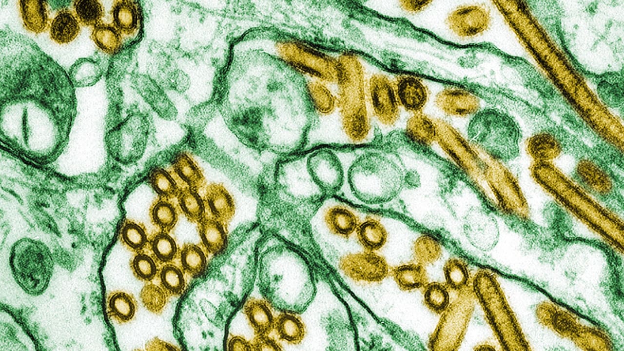 CDC Mengonfirmasi Kasus Pertama Flu Burung Parah di AS
