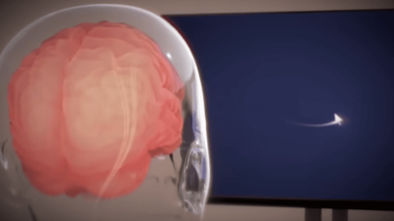 Neuralink Elon Musk akan menguji chip otak yang mengubah permainan untuk mengendalikan lengan robot.