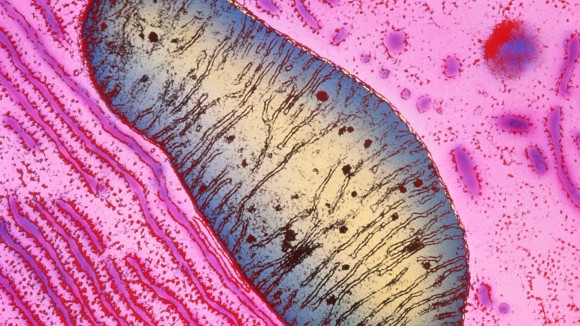 Mitokondria Bisa Berpindah Antar Sel, Sel Kanker Gunakan Cara Ini untuk Kalahkan Sel Imun