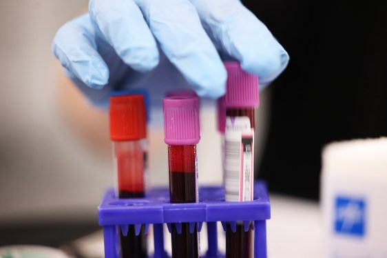 Serangan Ransomware Ganggu Suplai Darah Penting di New York Blood Center