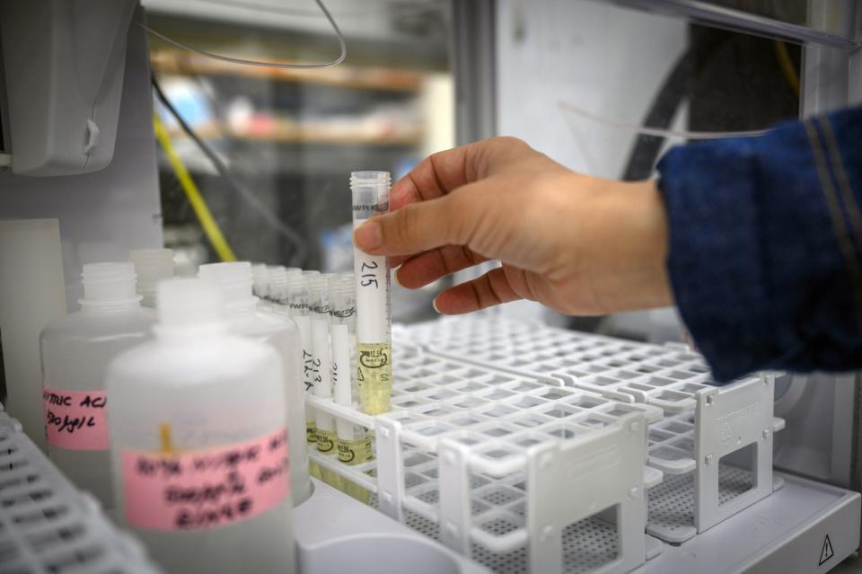 Dampak Pemotongan Dana NIH Terhadap Universitas dan Riset Medis di AS