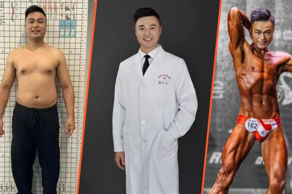 Dokter di China Turun 25kg dalam 42 Hari dan Juara Binaraga