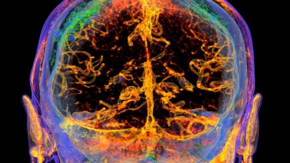 Terapi Gen untuk Memperkuat Penghalang Darah-Otak dan Memperbaiki Memori Usia Lanjut