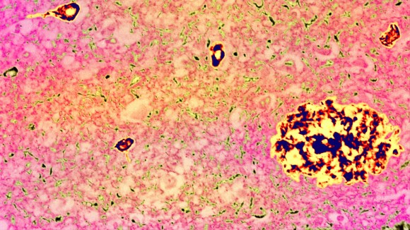 Peran Protein APP dalam Penuaan Otak Biasa dan Potensi Mengatasi Penurunan Memori