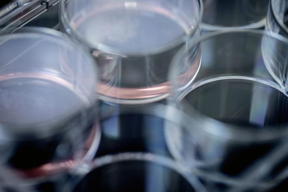 Innovent Kaji Kemitraan untuk Kembangkan Obat Kanker Inovatif IBI363