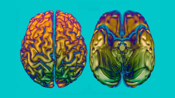 64 Gen Baru Ditemukan Memengaruhi Kecepatan Penuaan Otak Manusia