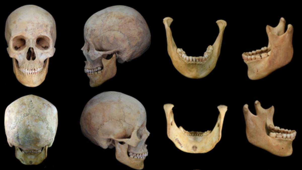 Penemuan Gigi Berwarna Merah Beracun Wanita Kuno di Jalur Sutra China