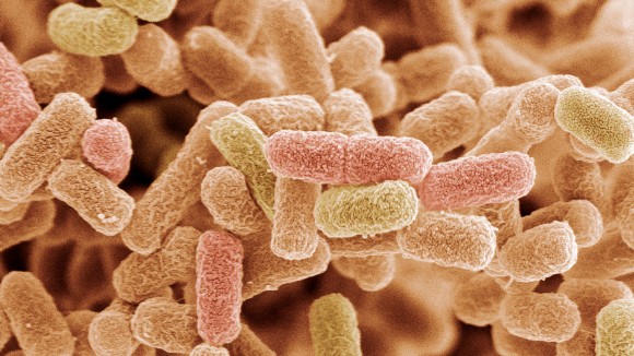 Peneliti Ciptakan Bioplastik Mirip Nilon dari Bakteri untuk Solusi Limbah Plastik