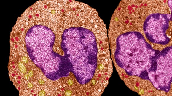 Neutrofil Perlindungi Luka dengan Membentuk Cincin Pelindung Kental