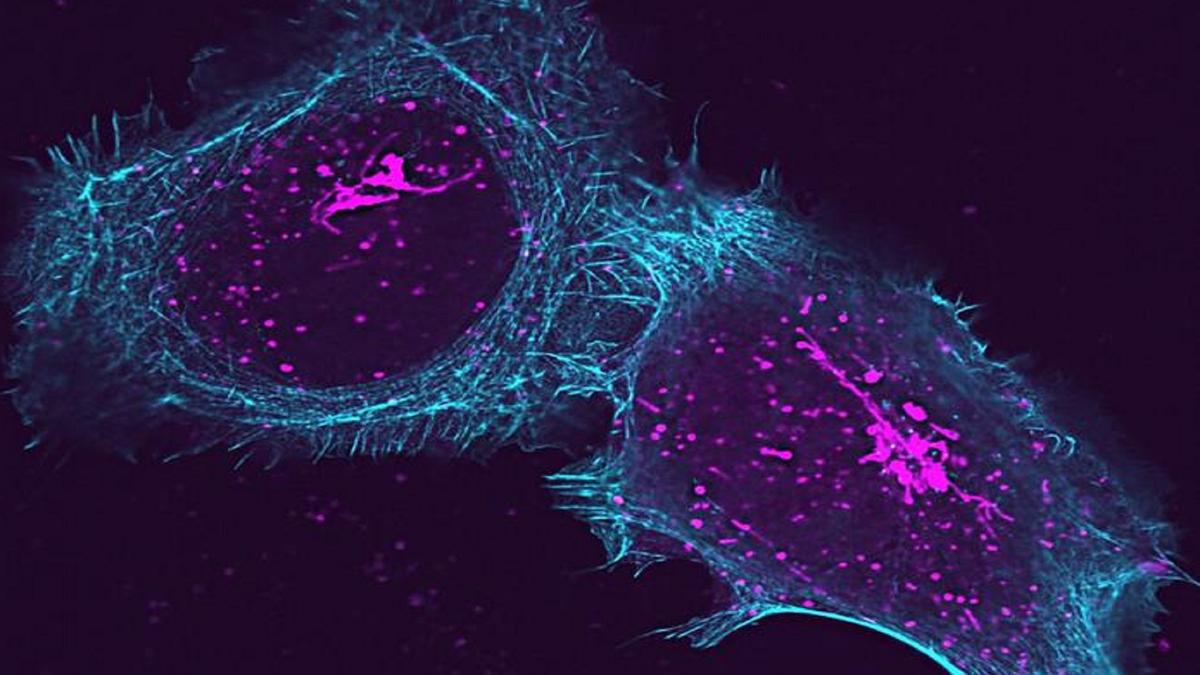 Protein Baru ArfGAP2 Buka Jalan Terapi untuk Penyakit Autoimun dan COVID-19
