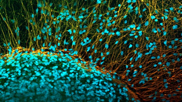 Terobosan Terapi Sel Punca Bantu Pria Lumpuh Bisa Berdiri Sendiri