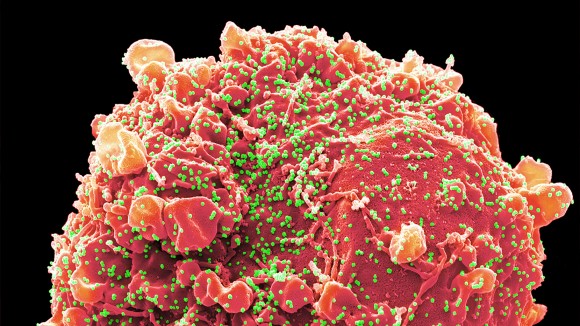 NIH dan CDC Hentikan Dana Penelitian COVID-19, Risiko Kesiapsiagaan Masa Depan