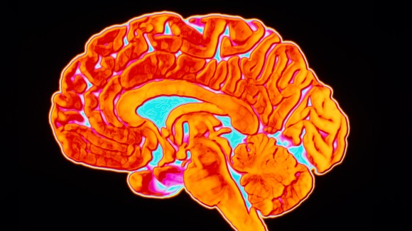 Peta Pertama Mitokondria Otak Manusia Buka Jalan Mengurai Penyakit Otak