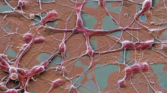 Sel Otak Pintar Bisa Hindari Sistem Imun untuk Sembuhkan Parkinson