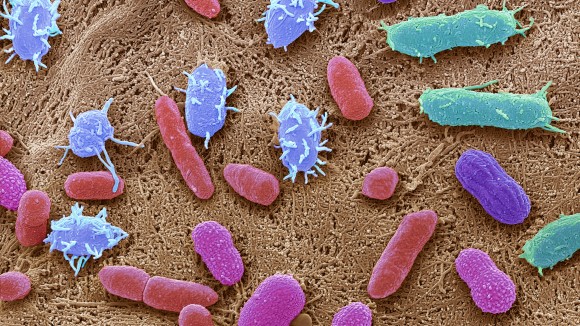 Terapi Mikroba Usus Menjanjikan Pengurangan Nyeri pada Fibromyalgia