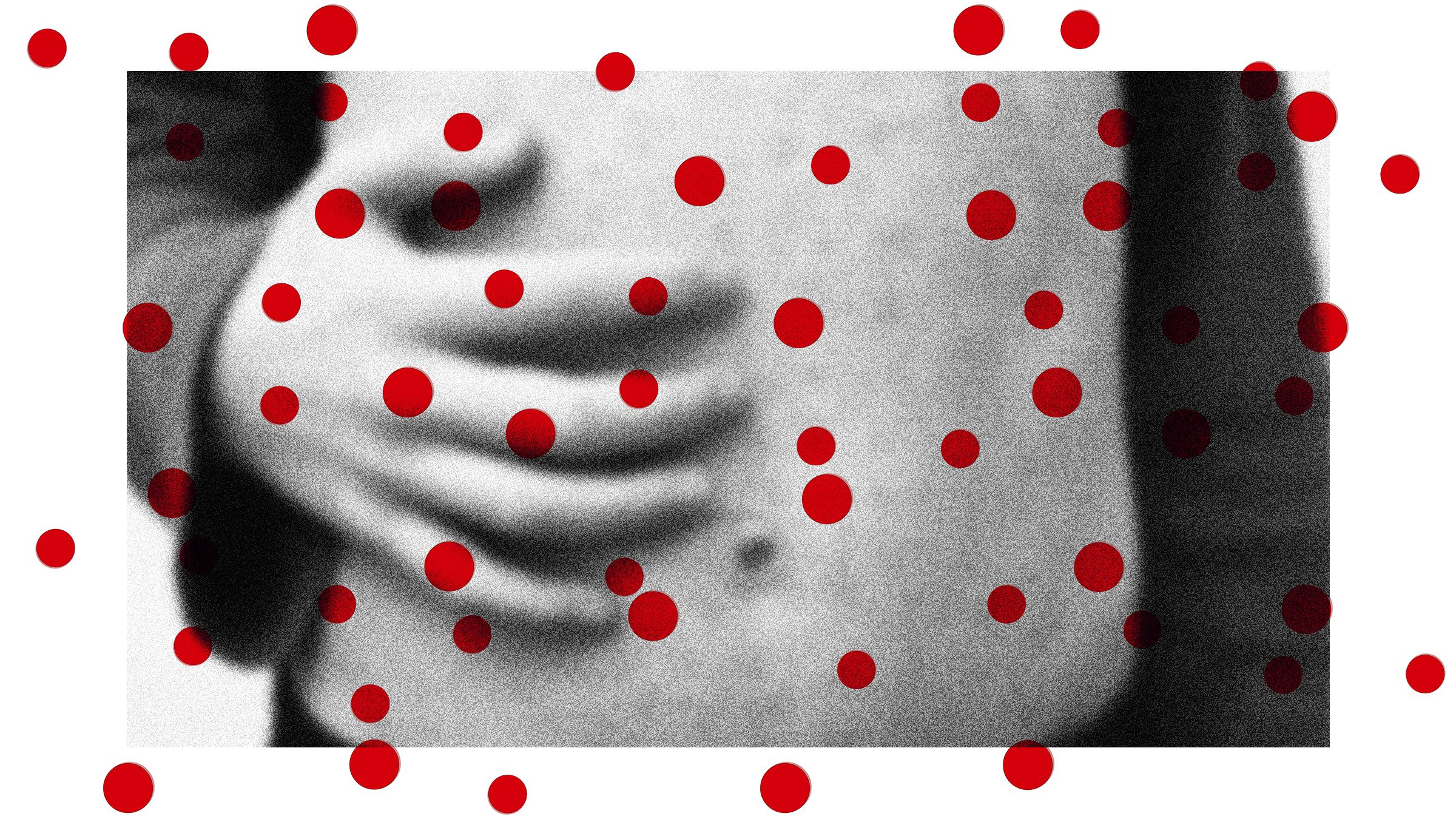 Wabah Pertusis dan Campak Meningkat: Pentingnya Vaksinasi Anak di AS