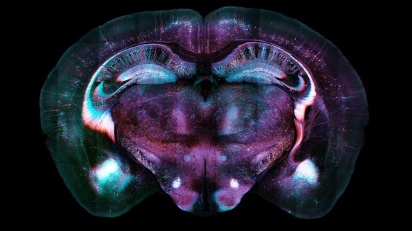 Mengenal Sinyal Otak yang Memulai Penghapusan Memori Takut pada Tikus