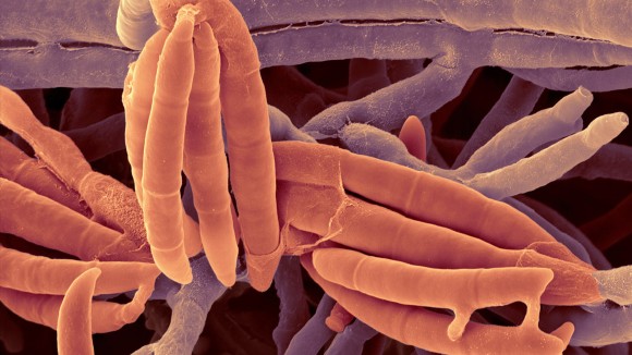 Jamur Usus Fusarium foetens Turunkan Gejala Penyakit Hati Berlemak