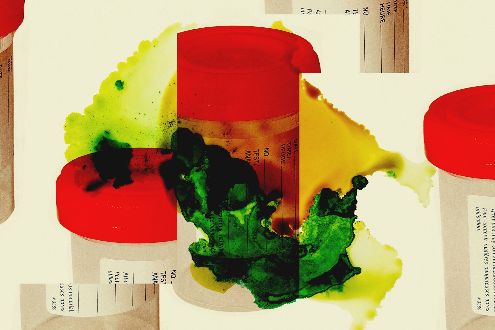 Pemutusan Kerja NIOSH Ancaman Rusaknya Ribuan Sampel Ilmiah Penting