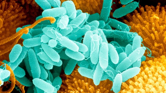 Bakteri Rumah Sakit Pseudomonas aeruginosa Punya Enzim Pengurai Plastik Berbahaya