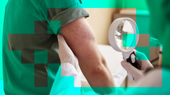 Google Perbarui Chatbot Medis, Diagnosa Ruam dan Gambar Medis Lebih Akurat