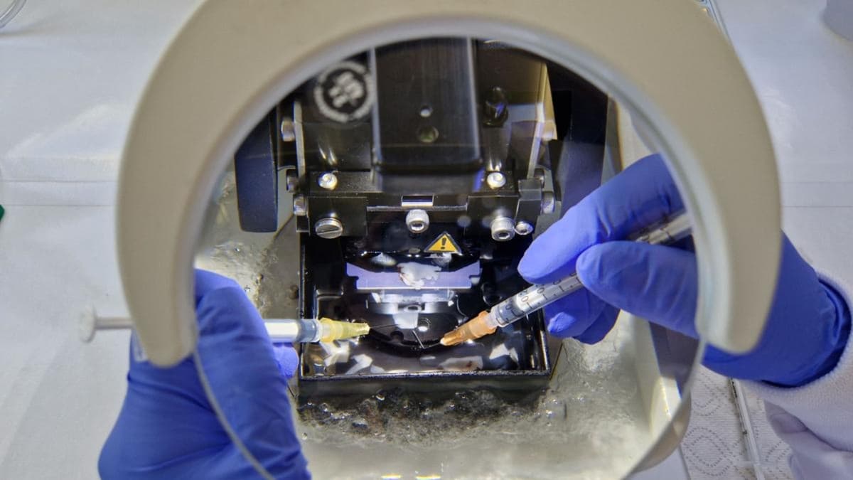 Penelitian Baru Ungkap Cara Protein Beracun Rusak Otak pada Alzheimer