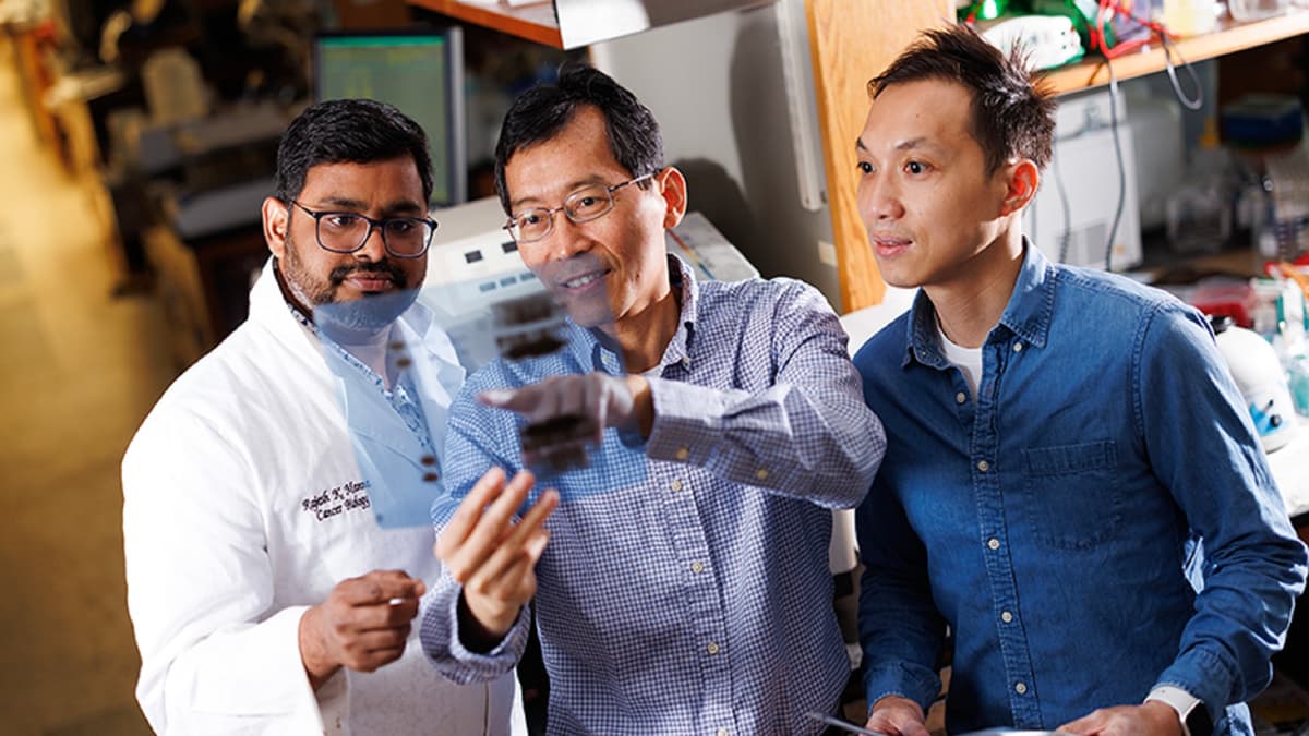 Protein ALDH4A1 Ungkap Rahasia Energi Sel Kanker dan Terobosan Terapi Baru