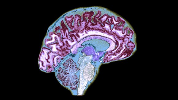 Sel T Khusus di Otak Kendalikan Perilaku Makan Melalui Sistem Imun