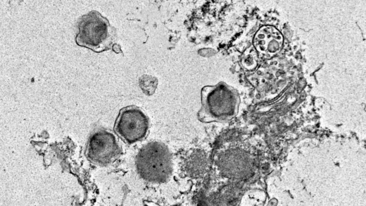 Penemuan 230 Virus Raksasa Baru yang Berperan di Ekosistem Laut Global