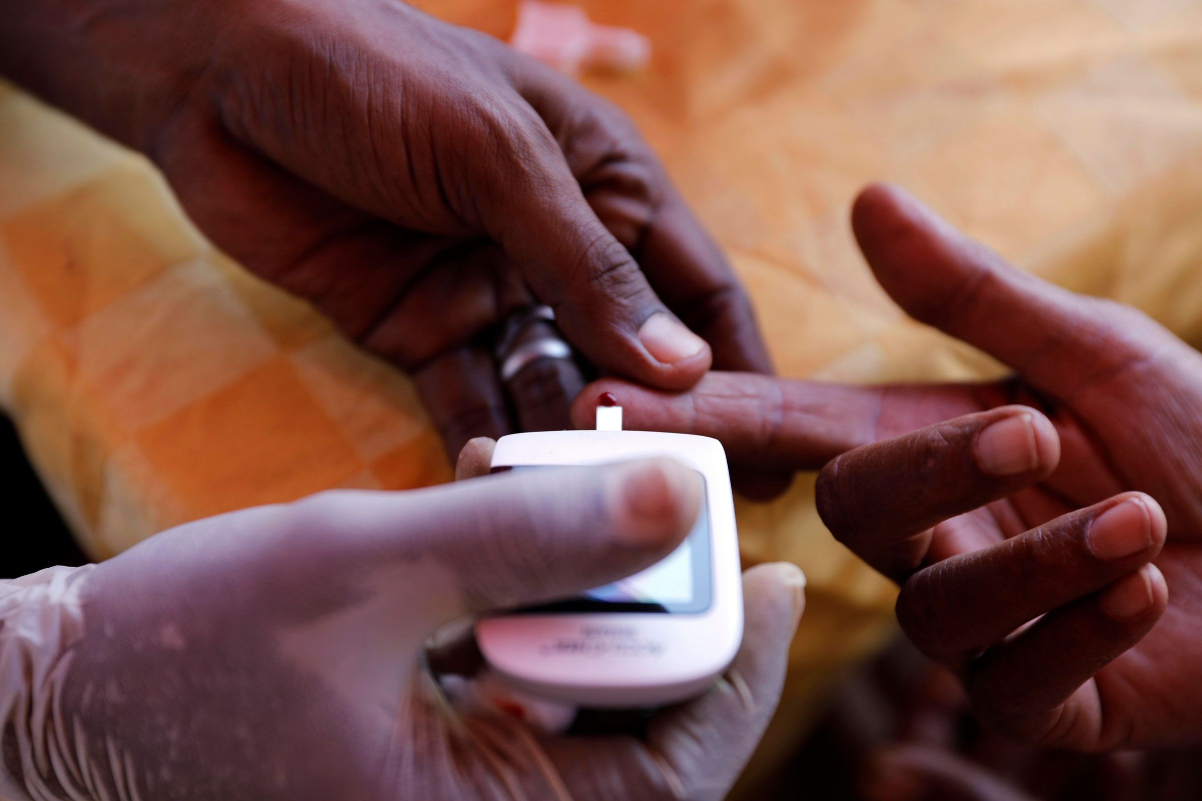 Menyelami Rahasia Diabetes di Afrika untuk Obat dan Diagnosis yang Lebih Baik