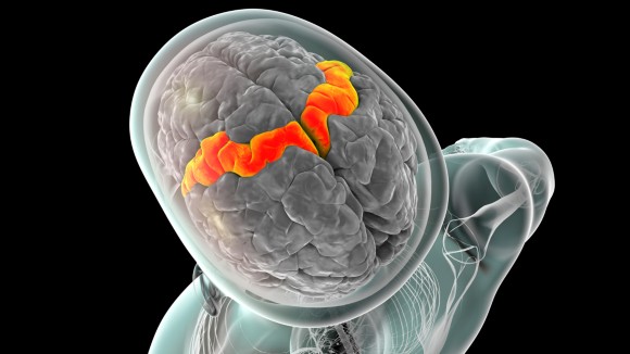 Alat Otak Pintar Bantu Pria Penderita ALS Bicara dan Bernyanyi Seperti Asli