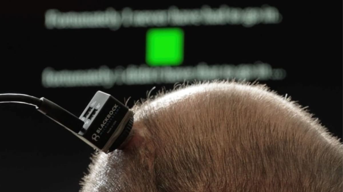 Inovasi BCI di UC Davis Bantu Pasien ALS Bicara Kembali Secara Real-Time