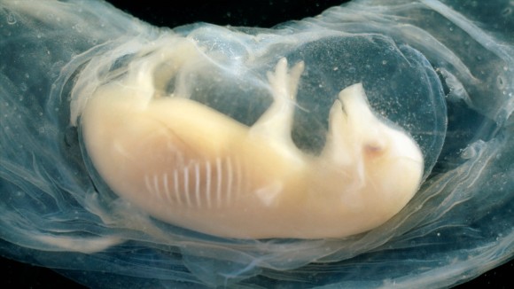 Ilmuwan Kembangkan Jantung Manusia dalam Embrio Babi yang Berdenyut