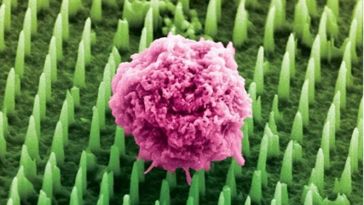 Patch Nanonadels Revolusioner Menghilangkan Nyeri Biopsi dan Mempercepat Diagnosa