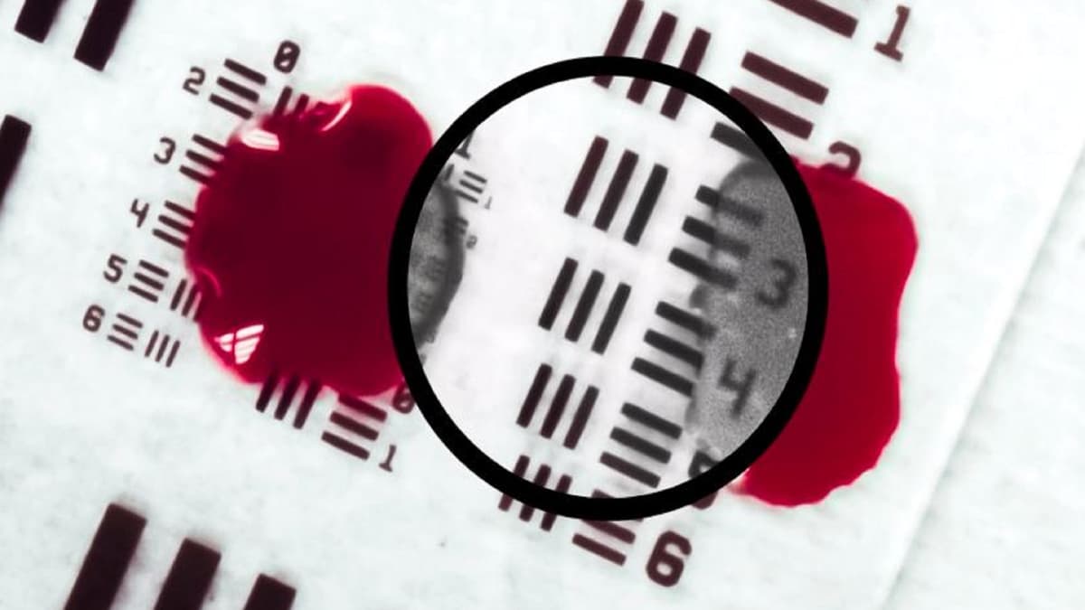 Teknologi Baru AI Membantu Dokter Melihat Melalui Darah Saat Operasi