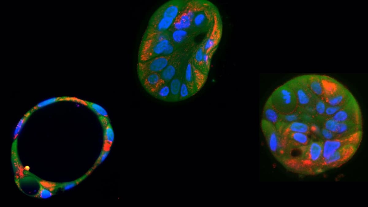 Peneliti Belanda Temukan Cara Baru Mengobati Penyakit Mitokondria dengan Precision Gene Editing