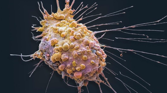 Masa Depan Biologi: Virtual Cell AI Mempercepat Studi Sel Tumor