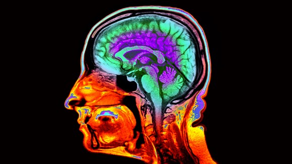 Mempercepat Deteksi Penuaan Otak dengan Citra MRI untuk Prediksi Risiko Kognitif