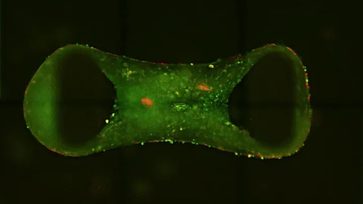 Organoid Jantung Miniatur Percepat Pengobatan Penyakit Jantung Anak