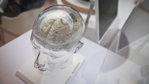 Perkembangan Cepat Teknologi Brain–Computer Interface untuk Membantu Penderita Kelumpuhan di China