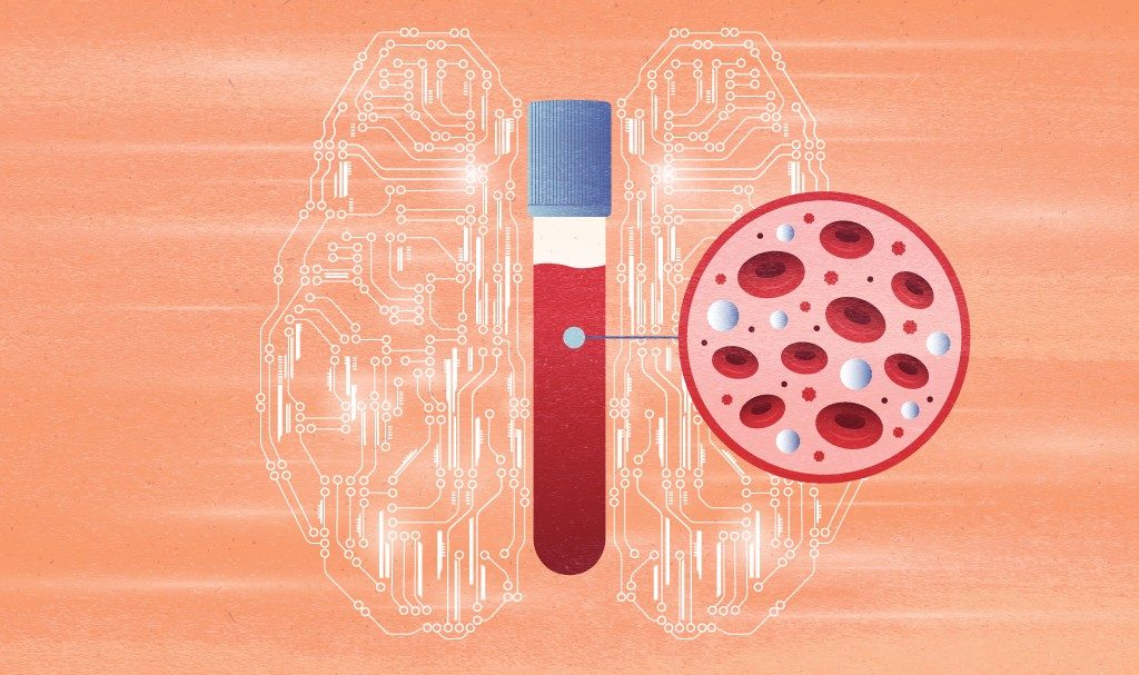 Metode AI 'Fragle' Mempermudah dan Mempercepat Pemantauan Kanker Lewat Darah